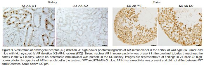 Figure 1. Verification of androgen receptor (AR) deletion. A: high-power photomicrographs of AR immunolabel in the cortex of wild-type (WT) mice and mice with kidney-specific AR deletion [KS-AR-knockout (KO)]. Strong nuclear AR immunoreactivity was present in the proximal tubules throughout the cortex in the WT kidney, where no detectable immunolabel was present in the KO kidney. Images are representative of findings in 24 mice. B: highpower photomicrographs of AR immunolabel in the testes of WT and KS-AR-KO mice. AR immunoreactivity was present and did not differ between WT and KO testes. Scale bars = 100 mm.