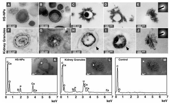 Figure 4. Morphology and chemical composition of mineralo-organic NPs and mineral particles found in kidney tissues. (A–E) Figure 4. Morphology and chemical composition of mineralo-organic NPs and mineral particles found in kidney tissues. (A–E)