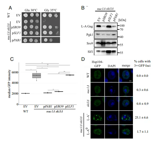 Fig. 3. Overexpression of translation control factors alleviates L-A pathogenesis. (A) Spot test growth assays of the high copy suppressors SRO9, SLF1, and PAB1 are shown. Strains were spotted on –LEU media containing either glucose or glycerol and grown at the indicated temperatures. (B) Western blotting for L-A Gag, Pgk1, Sro9, and Slf1 protein levels in the strains from 3A. Molecular weight markers are indicated on the right. (C) Flow cytometry was used to measure HSE GFP expression in the indicated strains (n = 3). The first and third quartiles are marked by the grey boxes. The median GFP intensity is marked by the black bars within. *P < 0.05, **P < 0.01, ***P < 0.001 (unpaired Student's t test). (D) Fluorescence microscopy of Hsp104-GFP in indicated strains. Cells were stained with DAPI to visualize nuclei. (Scale bar, 1 μm.) The percentage of cells with 3+ GFP foci is shown on the right. n = 3. 75 to 140 cells were counted for each replicate. Fig. 3. Overexpression of translation control factors alleviates L-A pathogenesis. (A) Spot test growth assays of the high copy suppressors SRO9, SLF1, and PAB1 are shown. Strains were spotted on –LEU media containing either glucose or glycerol and grown at the indicated temperatures. (B) Western blotting for L-A Gag, Pgk1, Sro9, and Slf1 protein levels in the strains from 3A. Molecular weight markers are indicated on the right. (C) Flow cytometry was used to measure HSE GFP expression in the indicated strains (n = 3). The first and third quartiles are marked by the grey boxes. The median GFP intensity is marked by the black bars within. *P < 0.05, **P < 0.01, ***P < 0.001 (unpaired Student's t test). (D) Fluorescence microscopy of Hsp104-GFP in indicated strains. Cells were stained with DAPI to visualize nuclei. (Scale bar, 1 μm.) The percentage of cells with 3+ GFP foci is shown on the right. n = 3. 75 to 140 cells were counted for each replicate.
